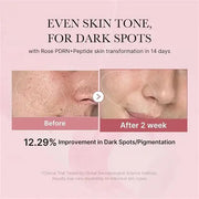 Medicube PDRN Pink Cica Soothing Toner