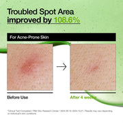 Anua Azelaic Acid 10 Hyaluron Redness Soothing Serum