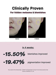 COSRX Niacinamide 15 Serum 20ml lightweight texture for oil control and pore refining